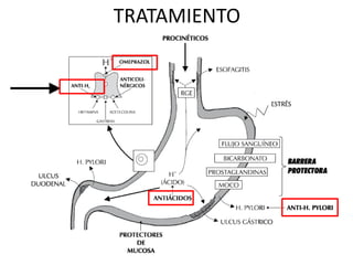 TRATAMIENTO
 