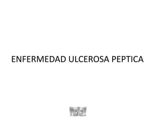 ENFERMEDAD ULCEROSA PEPTICA
 