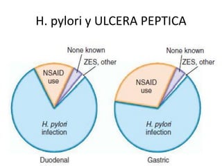 H. pylori y ULCERA PEPTICA
 