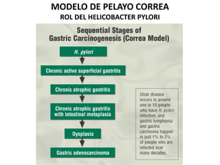MODELO DE PELAYO CORREA
ROL DEL HELICOBACTER PYLORI
 