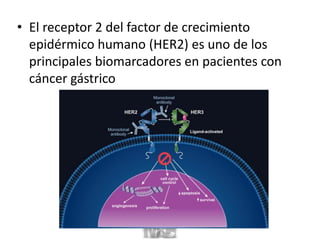 • El receptor 2 del factor de crecimiento
epidérmico humano (HER2) es uno de los
principales biomarcadores en pacientes con
cáncer gástrico
 