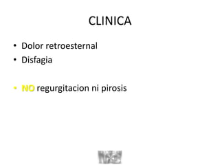 CLINICA
• Dolor retroesternal
• Disfagia
• NO regurgitacion ni pirosis
 