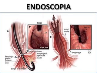 ENDOSCOPIA
 