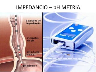 IMPEDANCIO – pH METRIA
 