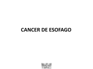 CANCER DE ESOFAGO
 