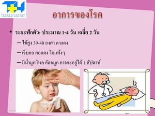 • ระยะฟักตัว: ประมาณ 1-4 วัน เฉลี่ย 2 วัน
–ไข้สูง 39-40 องศา ตาแดง
–เจ็บคอ คอแดง ไอแห้งๆ
–มีน้ามูกไหล คัดจมูก อาจจะอยู่ได้1 สัปดาห์
21/07/58 5
 