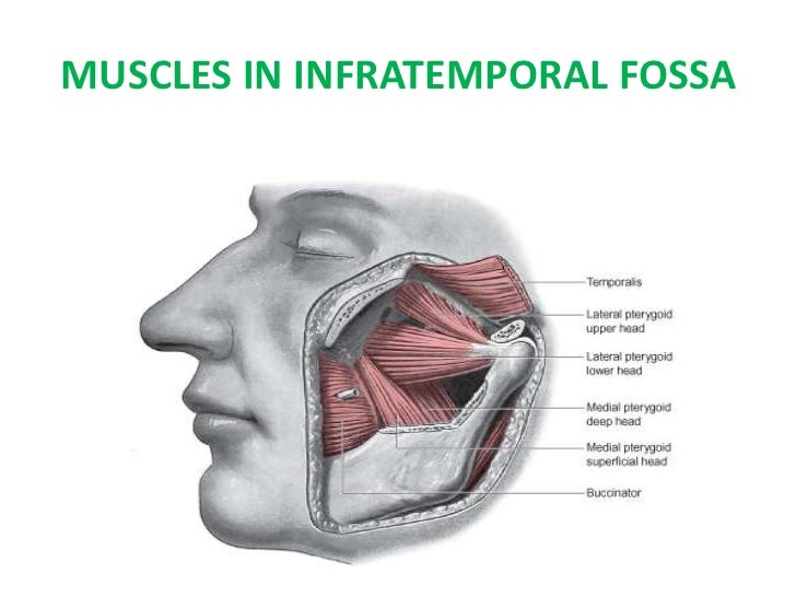 infratemporal fossa