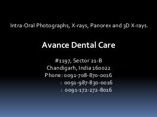 Intra-Oral Photographs, X-rays, Panorex and 3D X-rays.
#1197, Sector 21-B
Chandigarh, India 160022
Phone: 0091-708-870-0016
: 0091-987-830-0016
: 0091-172-272-8016
Avance Dental Care
 