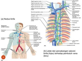 The lymphatic system. (a) General
distribution of lymphatic collecting
vessels and regional lymph nodes. The
area tinted pale green is drained by the
right lymphatic duct; the rest of the body
(tan) is drained by the thoracic duct. (b)
Major veins in the superior thorax
showing entry points of the thoracic and
right lymphatic ducts. The major
lymphatic trunks are also identified.
(a) Nodus limfa
(b) Letak dan percabangan saluran
limfa (hijau) terhadap pembuluh vena
(biru)
10
 