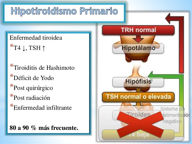 hipertiroidismo e hipotiroidismo ppt Hipertiroidismo e hipotiroidismo.