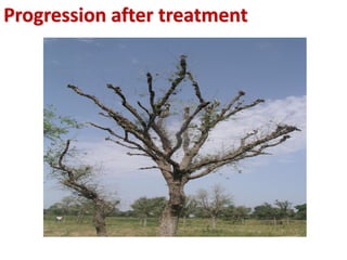 Progression after treatment
 