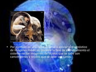 Por ejemplo en una red que se va a aplicar al diagnóstico de imágenes médicas; durante la fase de entrenamiento el sistema recibe imágenes de tejidos que se sabe son cancerígenos y tejidos que se sabe son sanos. 