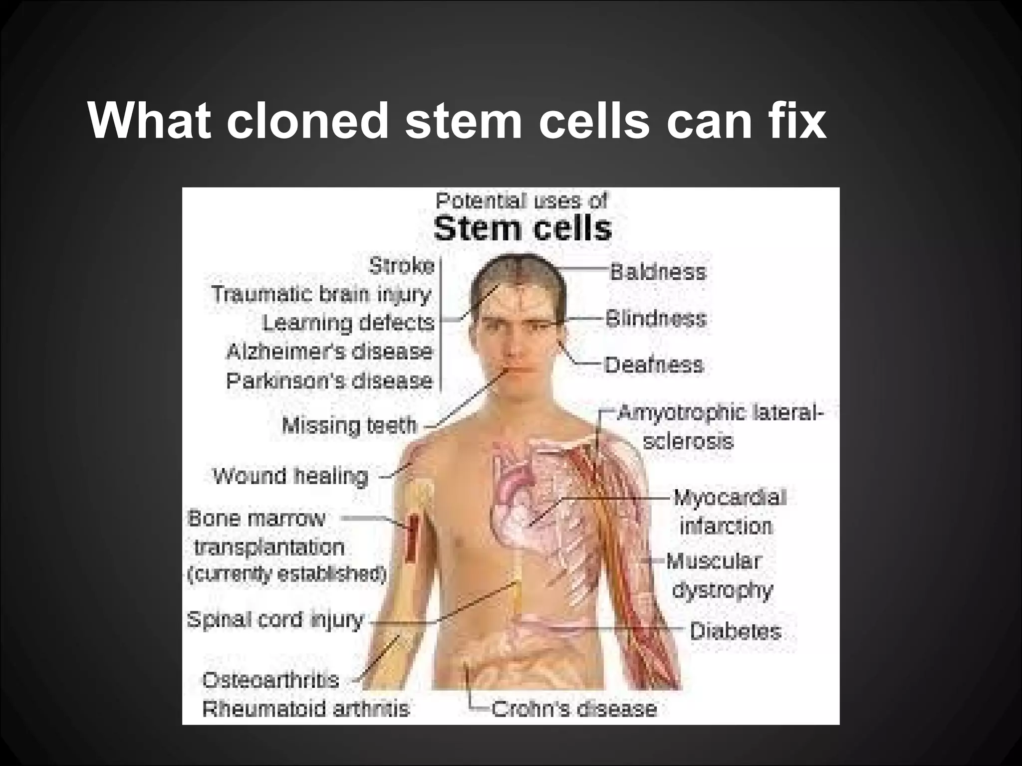 What cloned stem cells can fix