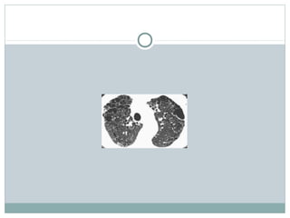 lung hrct patterns | PPT