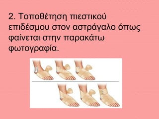 2. Τοποθέτηση πιεστικού
επιδέσμου στον αστράγαλο όπως
φαίνεται στην παρακάτω
φωτογραφία.
 