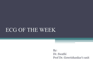 ECG OF THE WEEK By: Dr. Swathi Prof Dr. Gowrishankar’s unit 