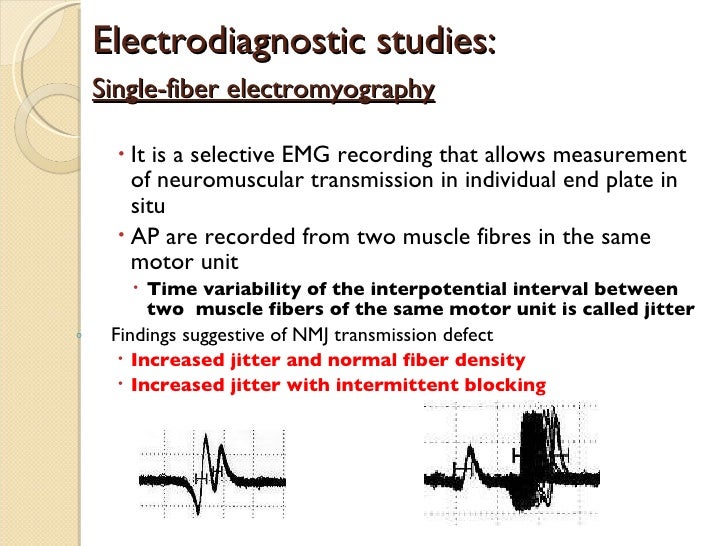 Myasthenia Gravis Management