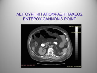 ΛΕΙΤΟΥΡΓΙΚΗ ΑΠΟΦΡΑΞΗ ΠΑΧΕΟΣ
ΕΝΤΕΡΟΥ CANNON'S POINT
 