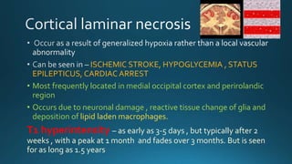 ISCHEMIC STROKE, HYPOGLYCEMIA , STATUS
EPILEPTICUS, CARDIAC ARREST
• Most frequently located in medial occipital cortex and perirolandic
region
• Occurs due to neuronal damage , reactive tissue change of glia and
deposition of lipid laden macrophages.
T1 hyperintensity – as early as 3-5 days , but typically after 2
weeks , with a peak at 1 month and fades over 3 months. But is seen
for as long as 1.5 years
 