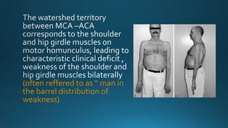 (often reffered to as “ man in
the barrel distribution of
weakness)
 