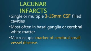 3-15mm CSF
marker of cerebral small
vessel disease.
LACUNAR
INFARCTS
 