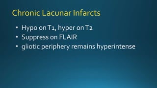 Chronic Lacunar Infarcts
 