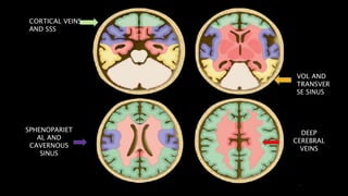 SPHENOPARIET
AL AND
CAVERNOUS
SINUS
DEEP
CEREBRAL
VEINS
VOL AND
TRANSVER
SE SINUS
CORTICAL VEINS
AND SSS
 