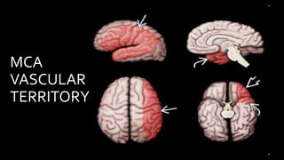 MCA
VASCULAR
TERRITORY
 