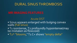 DURAL SINUSTHROMBOSIS
MR IMAGING FEATURES
Acute DST
(Fat sinus)
T2* "blooms "empty delta"
 