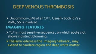 DEEPVENOUSTHROMBOSIS
IMAGING FEATURES
Thalamic edema is the imaging hallmark , may
extend to caudate region and deep white matter.
 