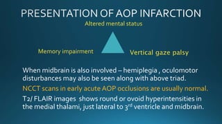 Altered mental status
Memory impairment
When midbrain is also involved – hemiplegia , oculomotor
disturbances may also be seen along with above triad.
NCCT scans in early acute AOP occlusions are usually normal.
T2/ FLAIR images shows round or ovoid hyperintensities in
the medial thalami, just lateral to 3rd ventricle and midbrain.
Vertical gaze palsy
 