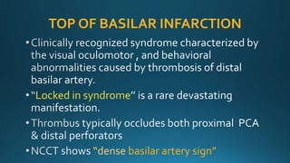 TOP OF BASILAR INFARCTION
Locked in syndrome
“dense basilar artery sign”
 