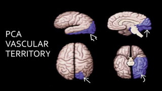 PCA
VASCULAR
TERRITORY
 