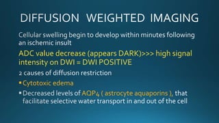 ADC value decrease (appears DARK)>>> high signal
intensity on DWI = DWI POSITIVE
Cytotoxic edema
AQP4 ( astrocyte aquaporins ),
 