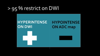 HYPERINTENSE
ON DWI
HYPOINTENSE
ON ADC map
 