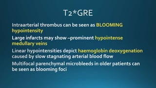 BLOOMING
hypointensity
Large infarcts may show –prominent hypointense
medullary veins
haemoglobin deoxygenation
 