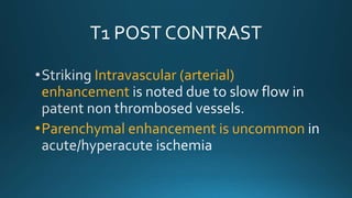 T1 POST CONTRAST
Intravascular (arterial)
enhancement
•Parenchymal enhancement is uncommon
 