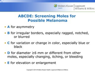 ABCDE: Screening Moles for 
Possible Melanoma 
• A for asymmetry 
• B for irregular borders, especially ragged, notched, 
or blurred 
• C for variation or change in color, especially blue or 
Copyright © 2014 Wolters Kluwer Health | Lippincott Williams & Wilkins 
black 
• D for diameter ≥6 mm or different from other 
moles, especially changing, itching, or bleeding 
• E for elevation or enlargement 
 