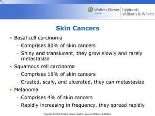 Skin Cancers 
• Basal cell carcinoma 
– Comprises 80% of skin cancers 
– Shiny and translucent, they grow slowly and rarely 
metastasize 
• Squamous cell carcinoma 
– Comprises 16% of skin cancers 
– Crusted, scaly, and ulcerated, they can metastasize 
Copyright © 2014 Wolters Kluwer Health | Lippincott Williams & Wilkins 
• Melanoma 
– Comprises 4% of skin cancers 
– Rapidly increasing in frequency, they spread rapidly 
 