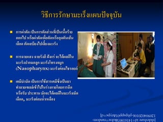วิธีการรักษามะเร็งแผนปัจจุบัน
   การผ่าตัด เป็นการตัดส่วนที่เป็นเนื้อร้าย
    ออกไป หรือผ่าตัดเพื่อตัดหรืออุดตันเส้น
    เลือด ตัดเสบียงไปเลี้ยงมะเร็ง

   การฉายแสง ฉายรังสี ฝังแร่ จะได้ผลดีใน
    มะเร็งปากมดลูก มะเร็งโพรงจมูก
    (Nasopharynx) มะเร็งต่อมไธรอยด์

   เคมีบาบัด เป็นการใช้สารเคมีซึ่งเป็นยา
    ทาลายเซลล์เข้าไปในร่างกายโดยการฉีด
    หรือรับ ประทาน มักจะได้ผลดีในมะเร็งเม็ด
    เลือด, มะเร็งต่อมน้าเหลือง

                                               120904020106-phpapp01&type=d]
                                               [slideshare id=14161803&doc=random-
 