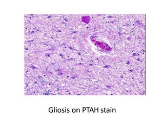 special stain | PPTX