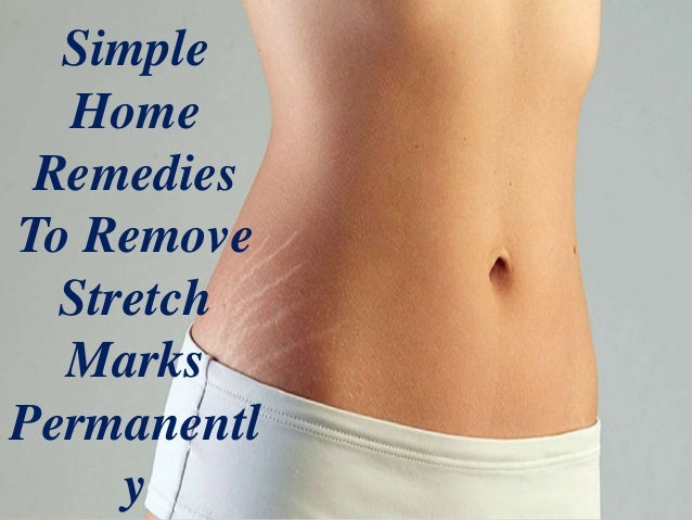 Medical Term For Stretch Markss On Abdomen