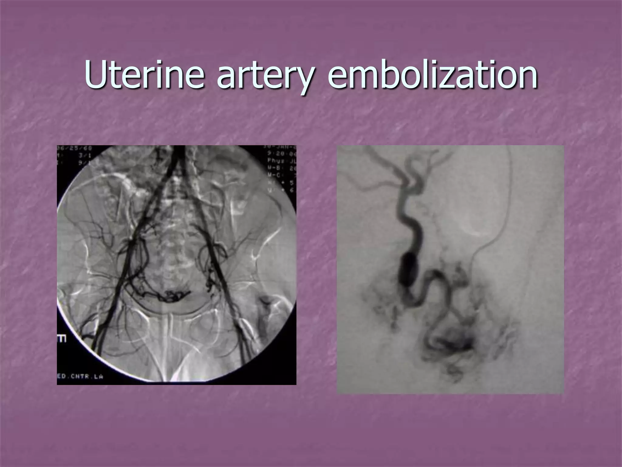 Introduction to Interventional Radiology.pptx