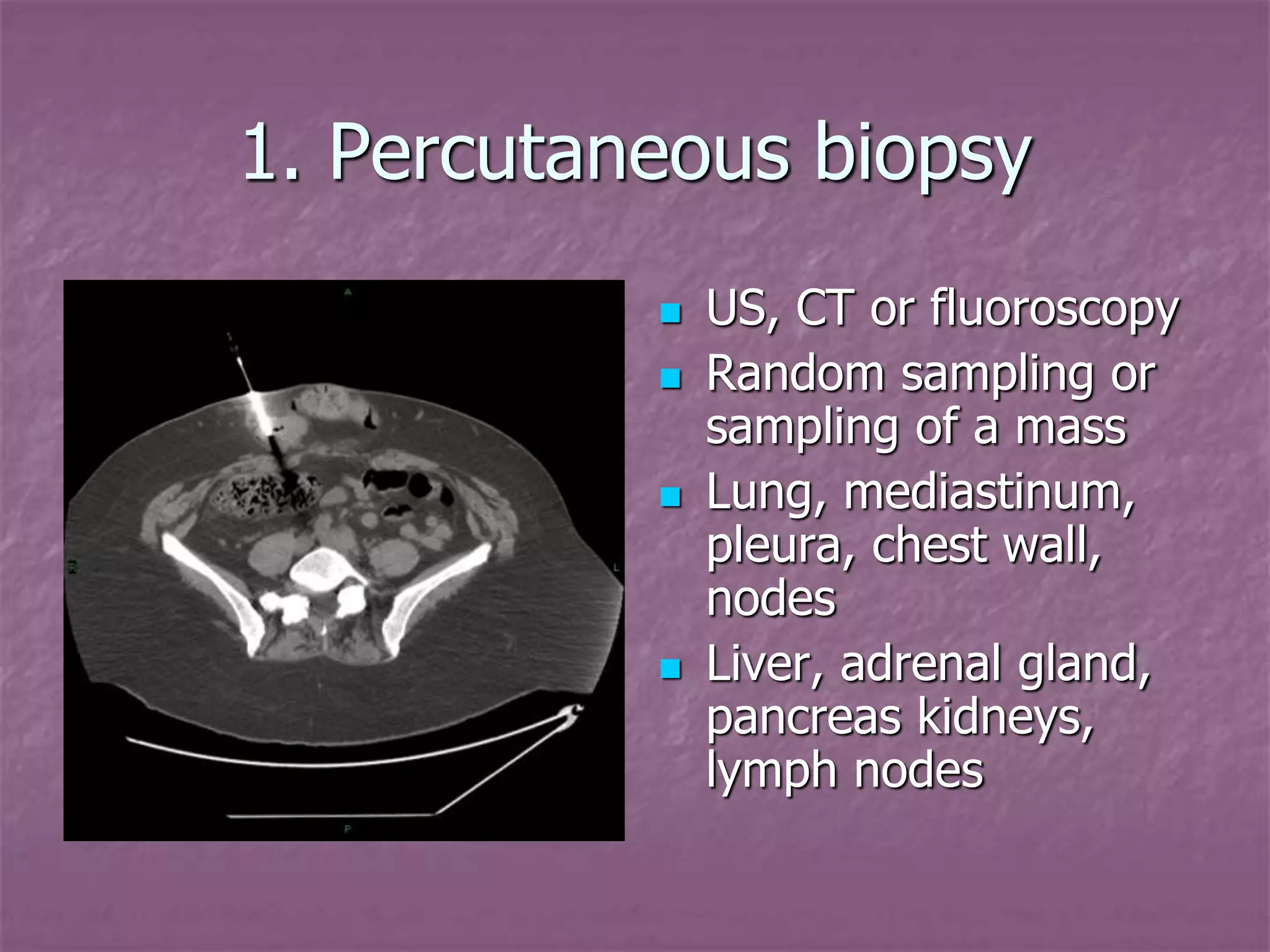 Introduction to Interventional Radiology.pptx