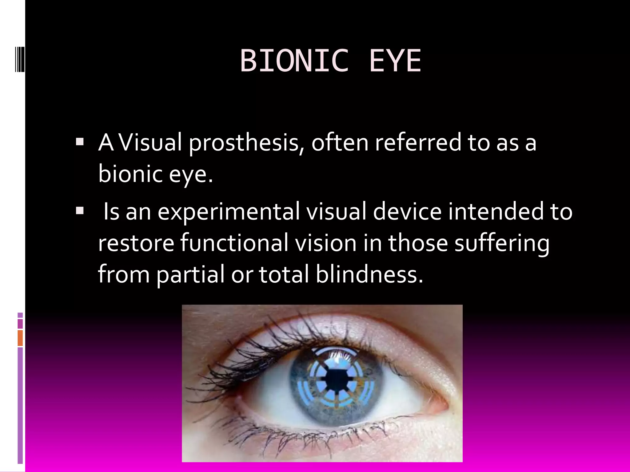 BIONIC EYE
 AVisual prosthesis, often referred to as a
bionic eye.
 Is an experimental visual device intended to
restore functional vision in those suffering
from partial or total blindness.
 