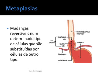    Mudanças
    reversíveis num
    determinado tipo
    de células que são
    substituídas por
    células de outro
    tipo.

              Nuno Correia 09/10
 