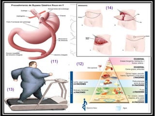 (14)

(11)

(13)

(12)

 