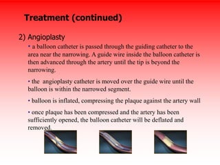 Ppt16 c [recovered] | PPT