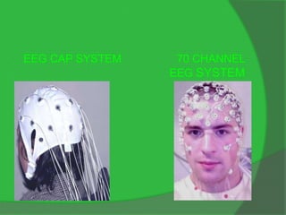 WIRELESS EEG | PPTX