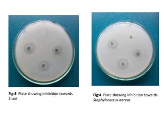 Fig:3 Plate showing inhibition towards
E.coli
Fig:4 Plate showing inhibition towards
Staphylococcus aereus
 